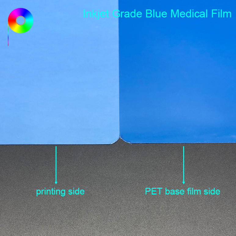 8*10" PET Material Blue Base China Inkjet Xray Printing Medical Dry X-ray Film for Medical Image Output