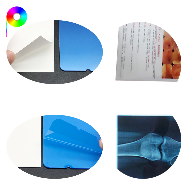 Laser Grade 130/160/182micron Various Sizes PET Medical Printing Film for Laser Printer